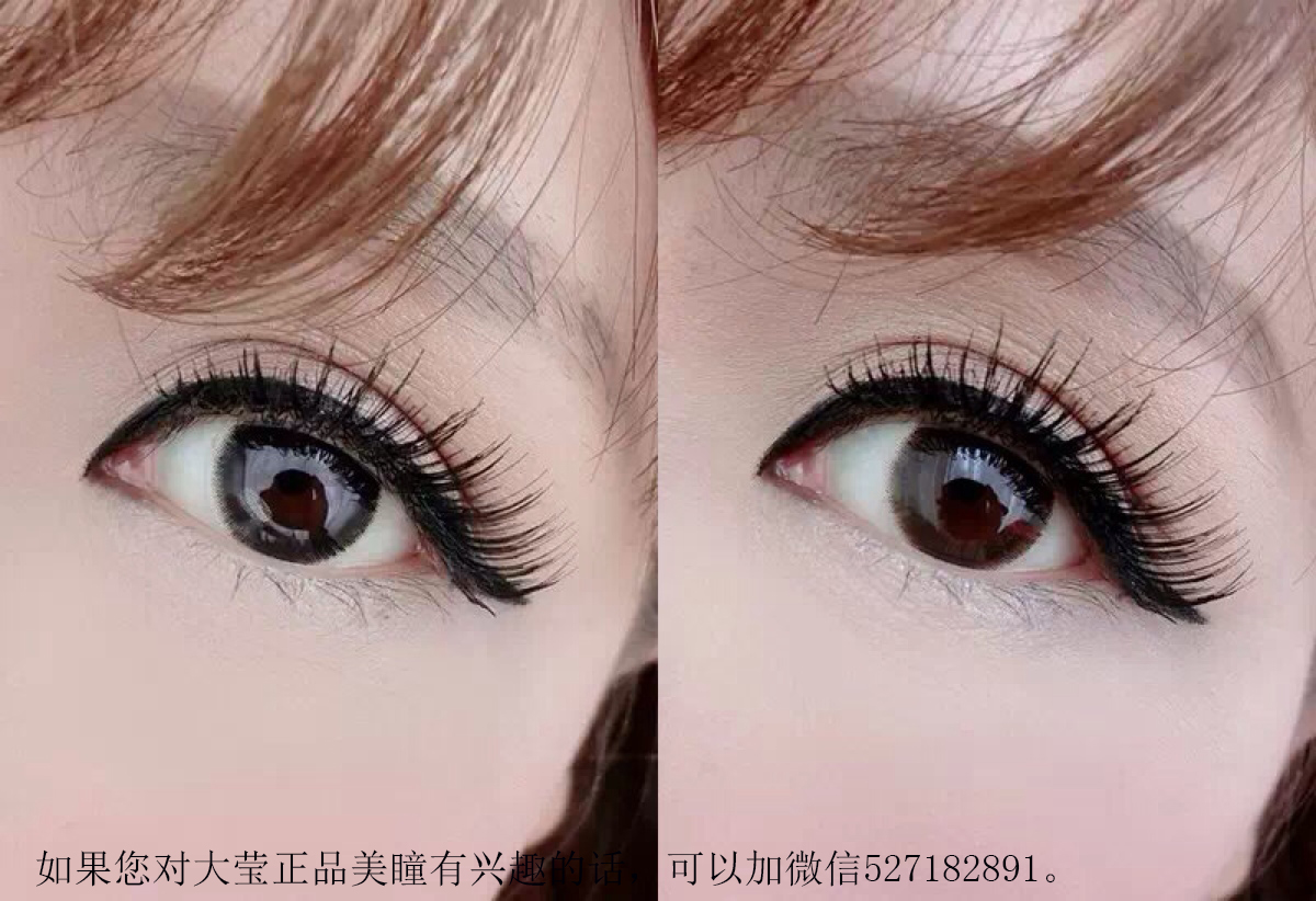 火狐电竞平台-每月五分钟自诊乳腺癌(图3) 火狐电竞官网