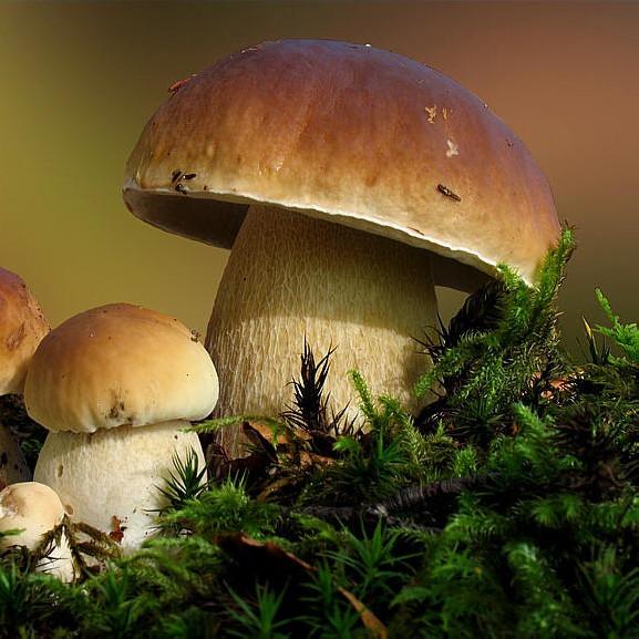 火狐电竞平台-子宫脱垂怎么办?不必都做手术(图2) 火狐电竞平台